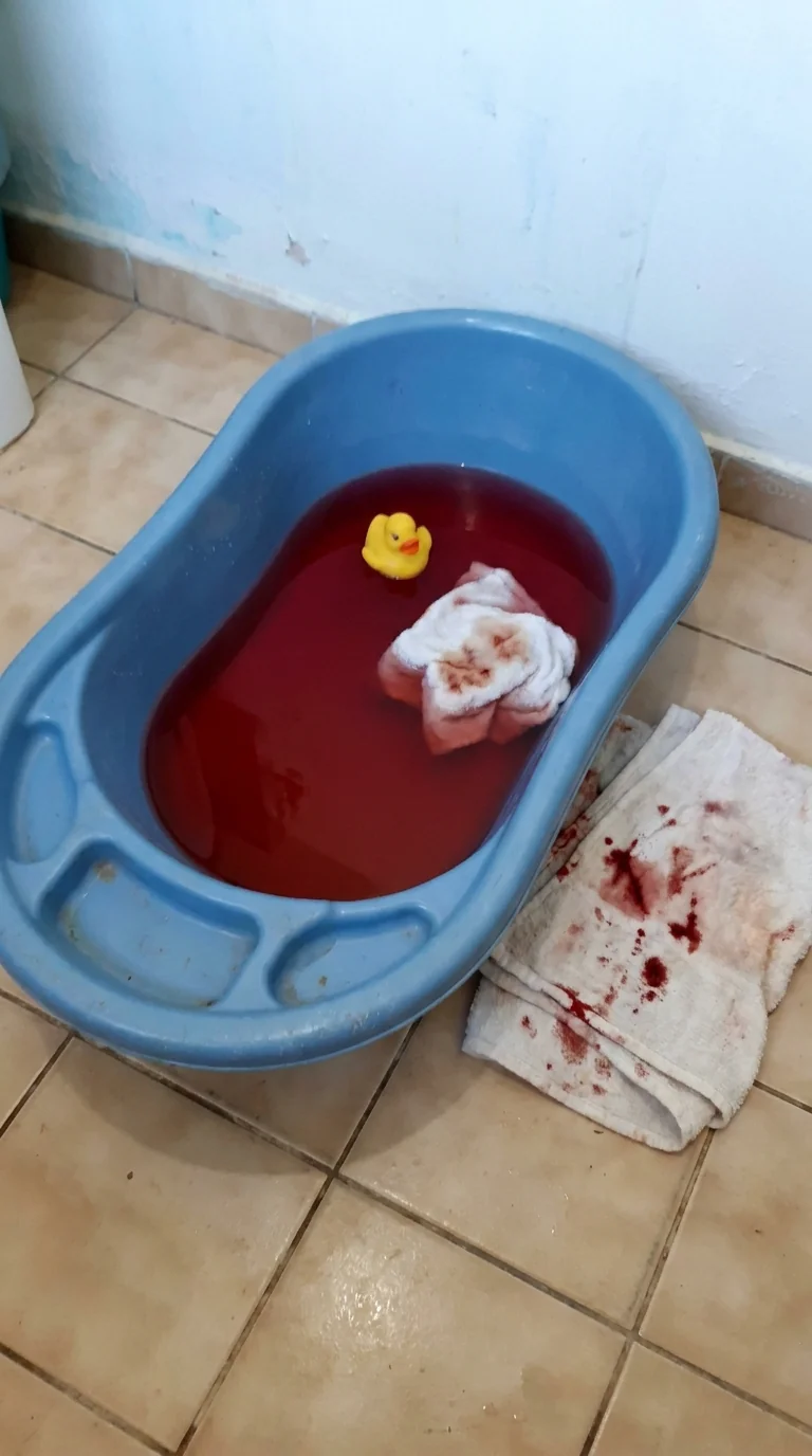 O banho do Leonardo, que termina com sangue na água